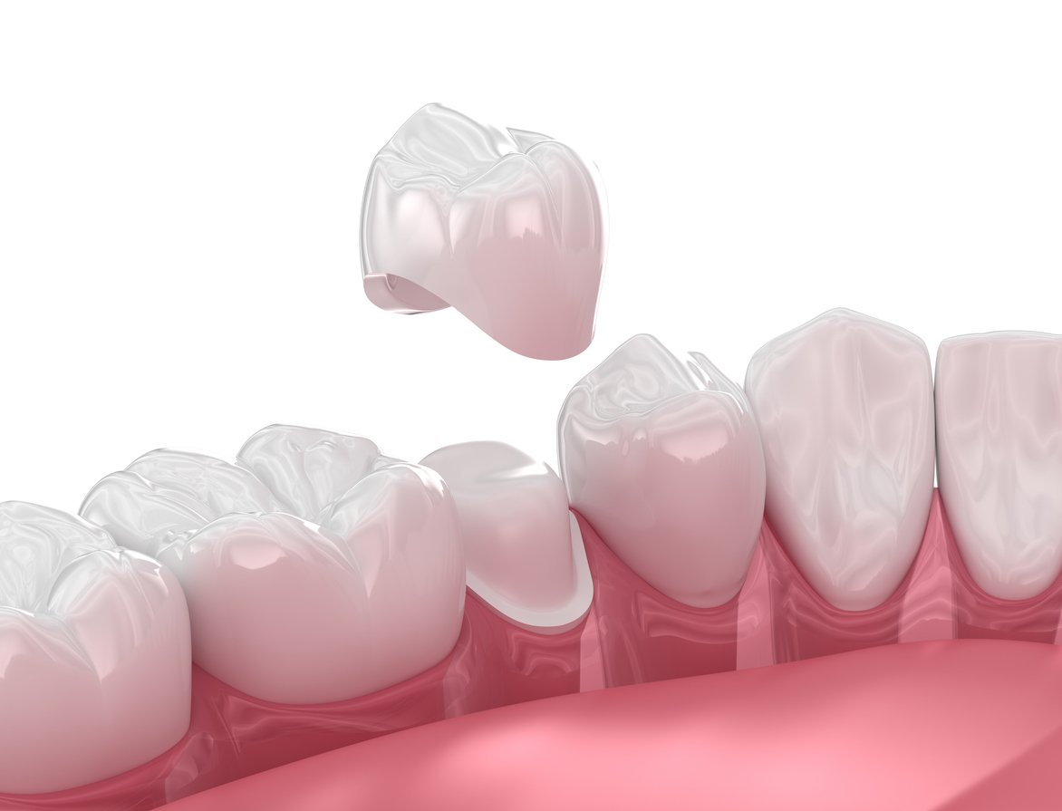 Dentist Evans GA