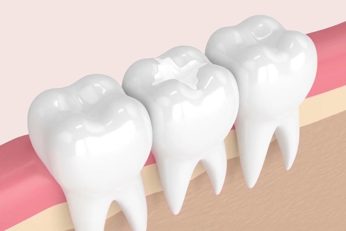 Evans GA Dentist