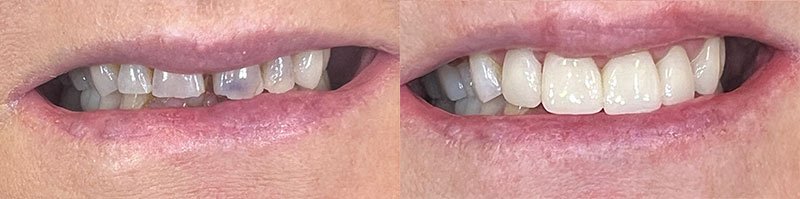 Dentist Evans GA