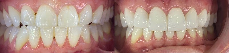 Evans Dentist