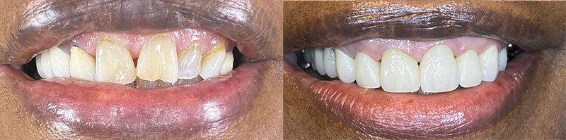 Dentist Evans GA