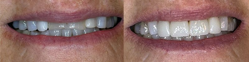 Evans GA Dentist