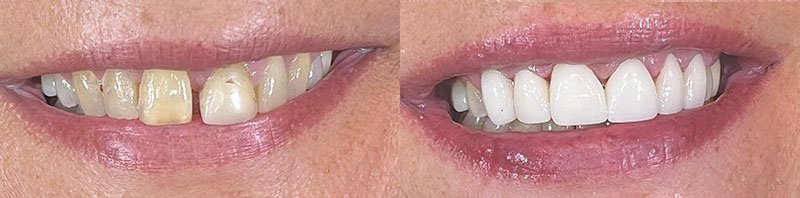 Dentist Evans GA
