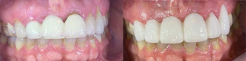 Evans Dentist