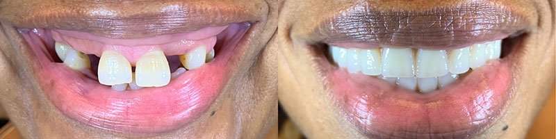Evans GA Dentist