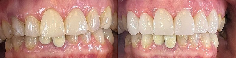 Dentist Evans GA